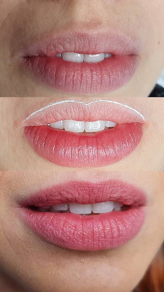 Foto 2 de Ana Lima Clinic & Academy | Micropigmentação de Lábios, Sobrancelhas e Estética.