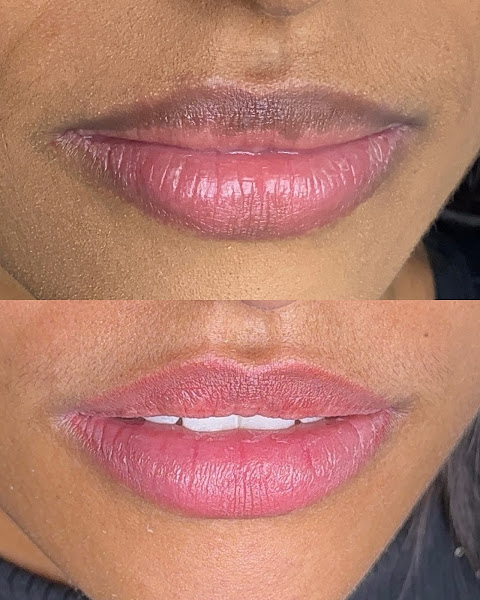 Foto 3 de Ana Lima Clinic & Academy | Micropigmentação de Lábios, Sobrancelhas e Estética.