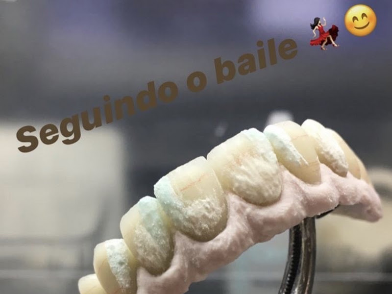 Foto 2 de Ana'rte bucal Prótese Odontologica