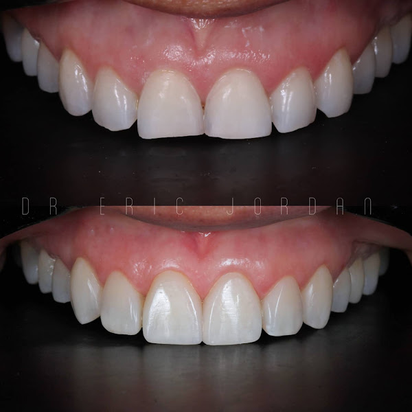 Foto 2 de Andrade Santos Odontologia - Dentista em Itapuã