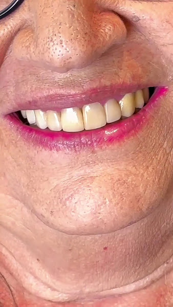 Foto 4 de Andrea Jacinto