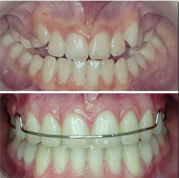 Foto 3 de Andrea Niino Basso - Cirurgiã Dentista