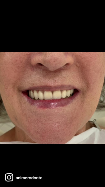 Foto 3 de AnimerOdonto – Reabilitação Oral e Implantes Dentários