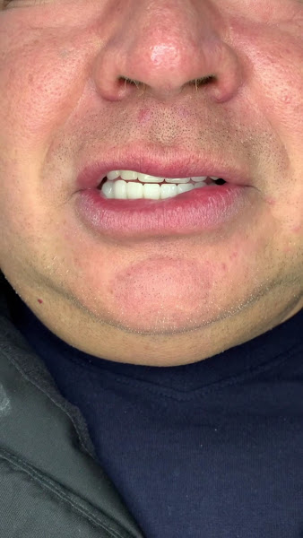 Foto 4 de AnimerOdonto – Reabilitação Oral e Implantes Dentários