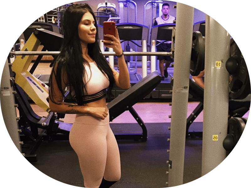 Foto 2 de Anna Umbelino Harmonização Orofacial