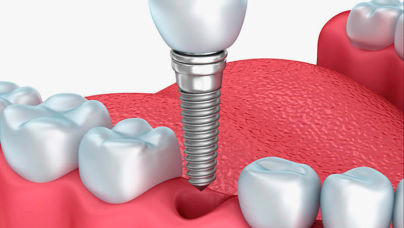 Foto 2 de Aoki Dental Studio - Dr. Victor Aoki - Cro 76827 - Franco da Rocha