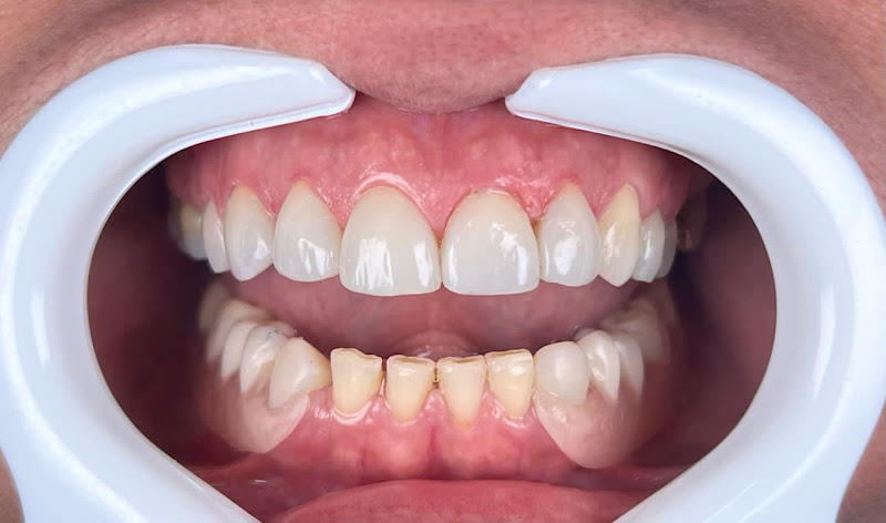 Foto 2 de AOliveira Clinica Odontologica e Protese