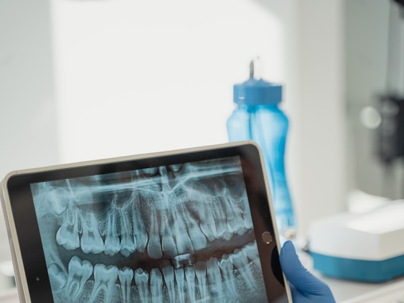 Foto 9 de AOP Implantes | Dentista no Tatuapé