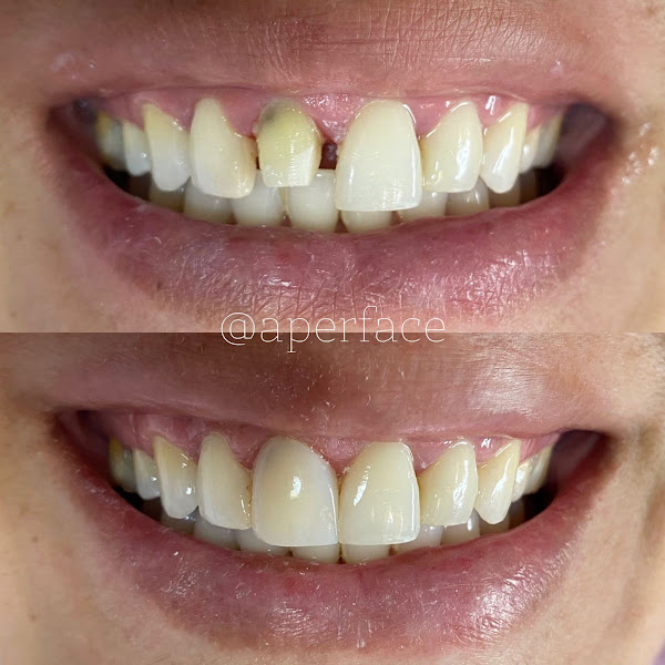 Foto 2 de Aperface Aperfeiçoando Sorrisos -Clínica Odontológica -