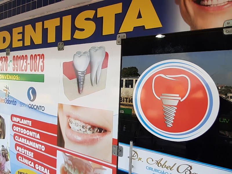 Foto de Apoiar