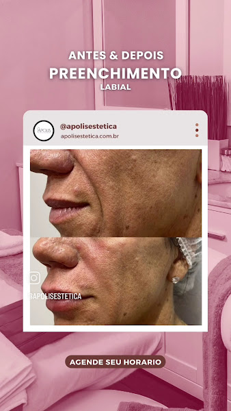 Foto 3 de Ápolis Estética