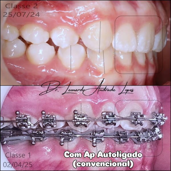 Foto 3 de Áppia Odontologia Avançada