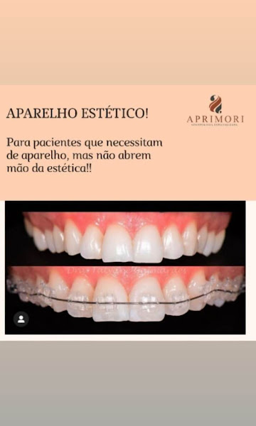 Foto 3 de Aprimori Odontologia Especializada