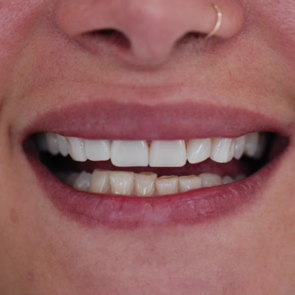 Foto 3 de Arão Odonto