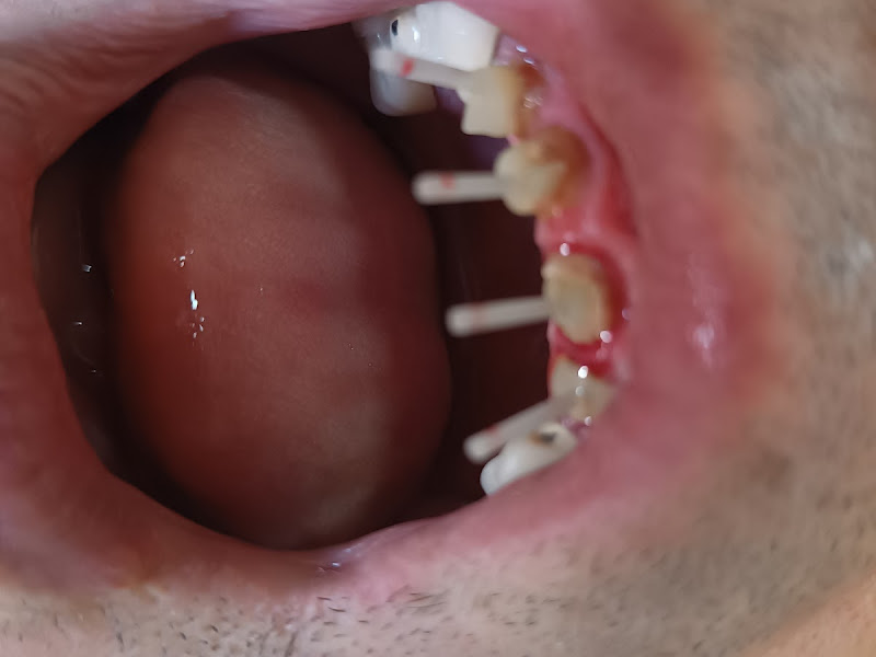 Foto 2 de Arceu Francisco Lorenzoni