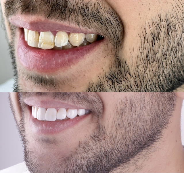 Foto 3 de Armonia Dentale Odontologia Integrada