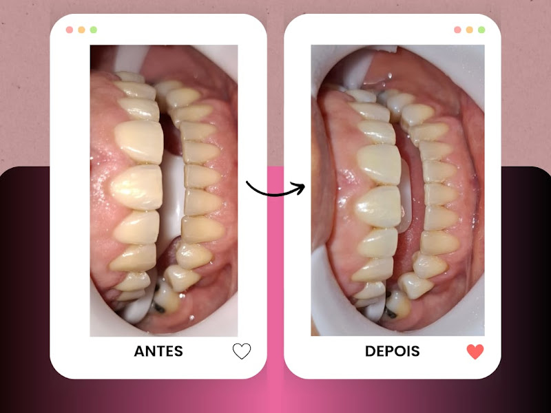 Foto 3 de Art de Sorrir - Dra Ana Oliveira