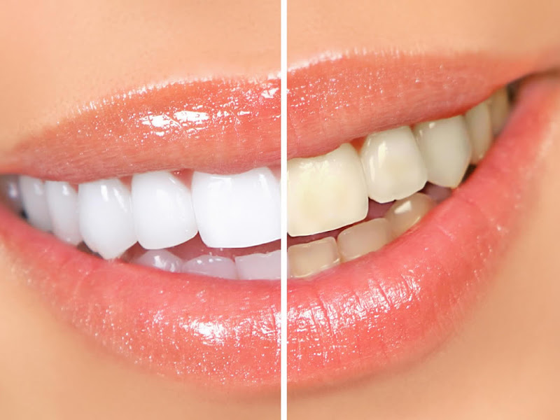 Art&Dent Tijuca 3 - Dentista com Preço Popular Rj, Dentista