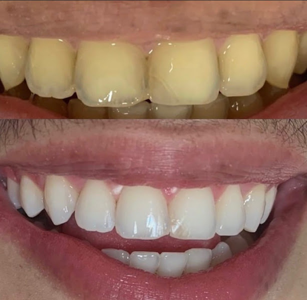 Foto 2 de ArtClin Odontologia