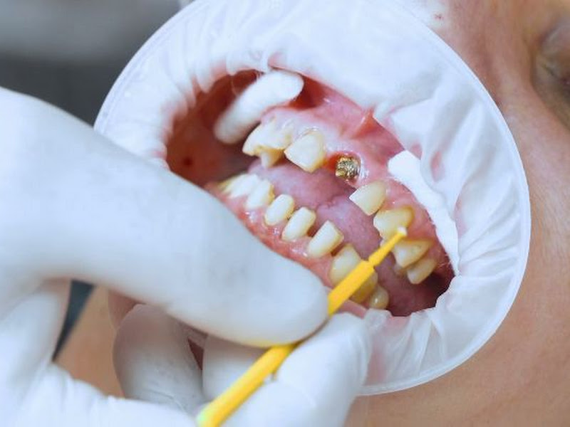 Foto 4 de Arte de Sorrir: Clinica odontológica - implante, lentes, clinica geral em Vitória - ES