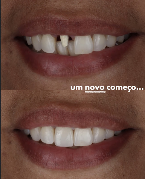 Foto 3 de Arte Dental serviços odontológicos / Clínica odontológica no Flamengo