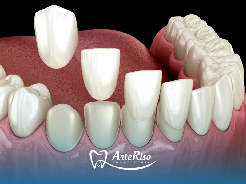 Foto 3 de ArteRiso Odontologia