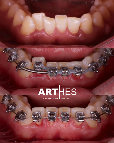 Foto 3 de Arthes odontologia