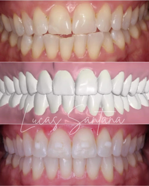 Foto 2 de ÁS Odonto - Ortodontia e Reabilitação Oral | Floresta BH