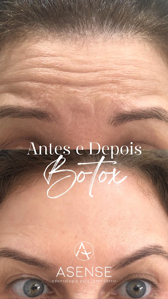 Foto 3 de Asense Odontologia