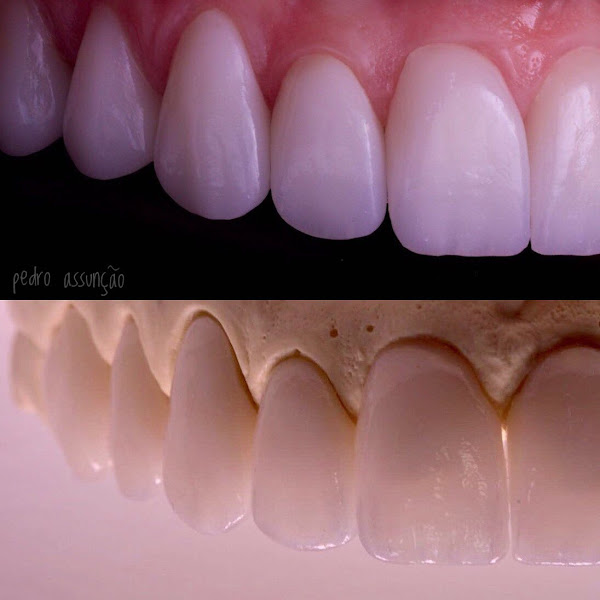 Foto 3 de Assunção Clinic - Dr. Pedro Assunção - Clínica Odontológica