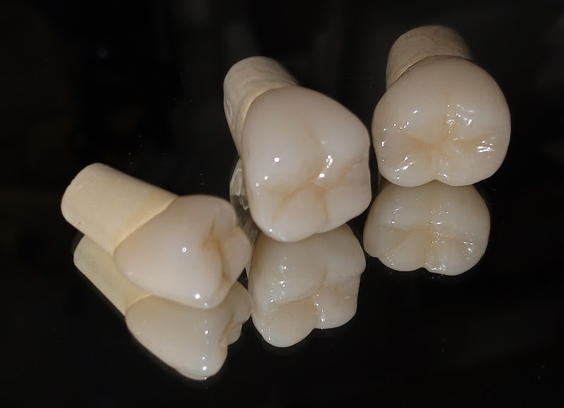 Foto 2 de Ateliê dental Angelo Gouvêa