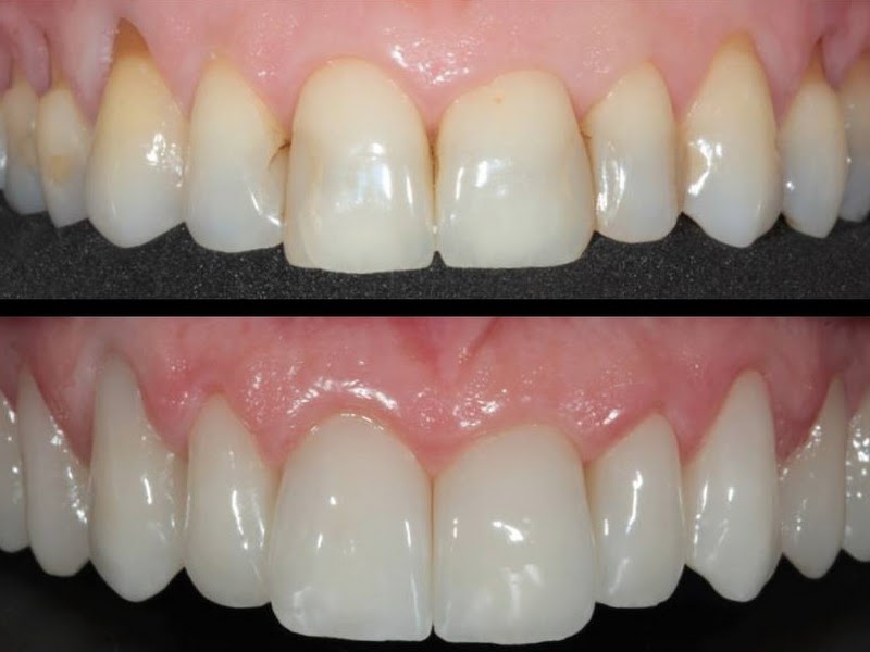 Foto 3 de Ateliê dental Angelo Gouvêa