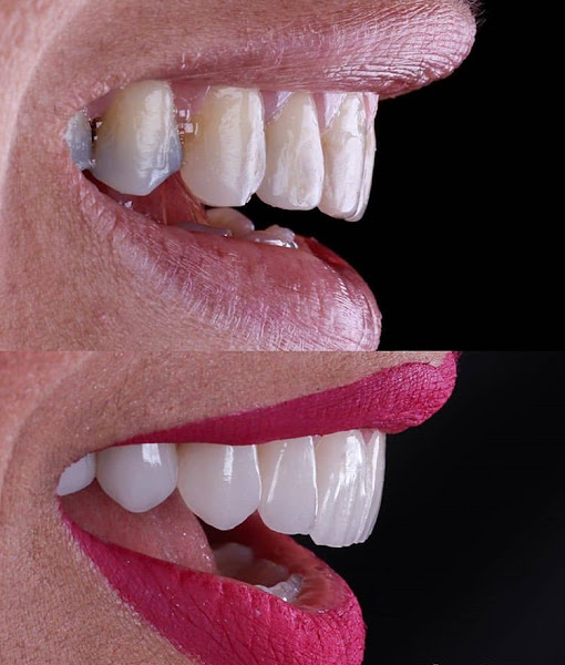 Foto 3 de Atelie do Dente