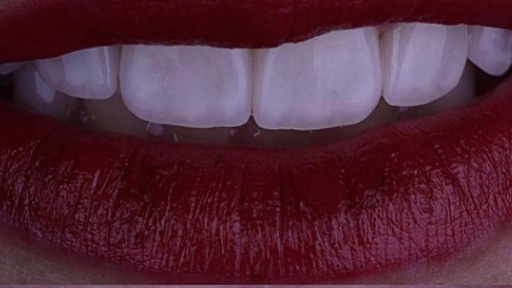 Foto 2 de Ateliê dos Dentes - Dentista Recreio dos Bandeirantes - Dra. Luana Serralva