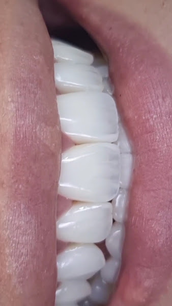 Foto 3 de Ateliê dos Dentes - Dentista Recreio dos Bandeirantes - Dra. Luana Serralva