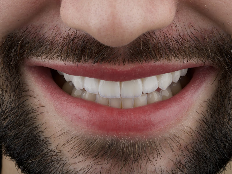 Foto de ATELIÊ ODONTOLÓGICO IVS / "Lentes de Contato Dental & Implantes"