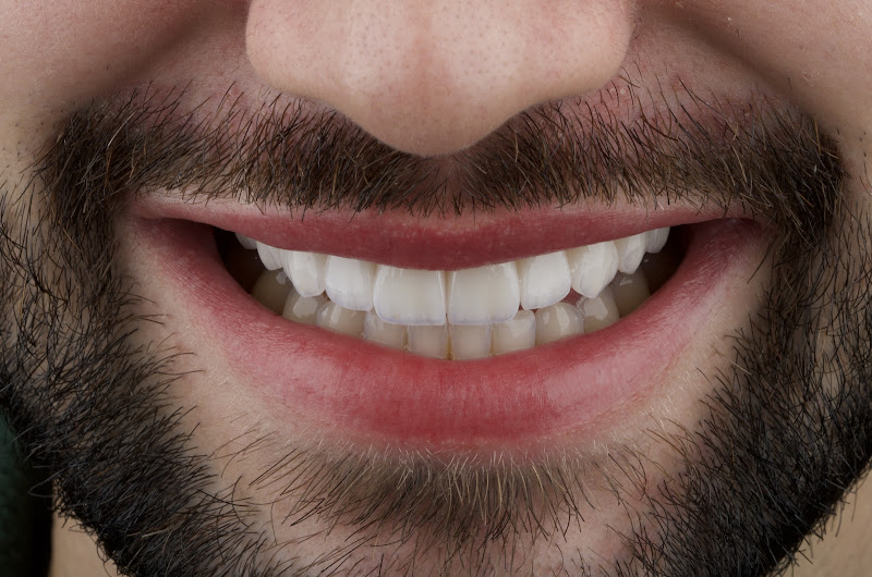 Foto 2 de ATELIÊ ODONTOLÓGICO IVS / "Lentes de Contato Dental & Implantes"