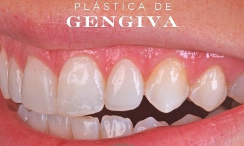 Foto 5 de Ateliê Oral | Clínica Odontológica Especializada em Reabilitação Oral no Itaim Bibi Zona Sul SP