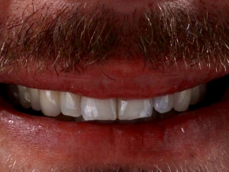 Foto 9 de Ateliê Oral | Clínica Odontológica Especializada em Reabilitação Oral no Itaim Bibi Zona Sul SP