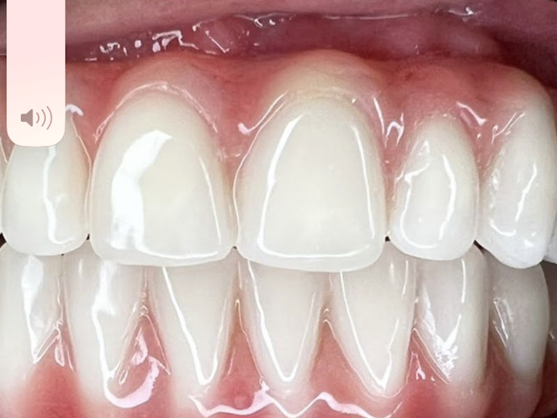 Foto 2 de Ateliê pròtese dentária