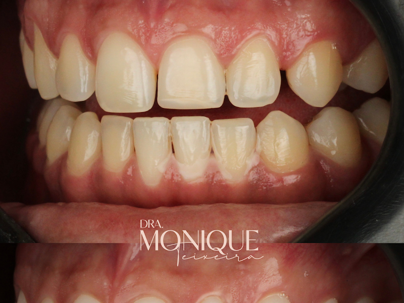 Foto 6 de Atitude Odontologia/ Estética Odontológica/ Implantes/ Endodontia/ Odontopediatria/ Clínica Geral/ Dentista Morumbi
