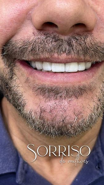 Foto 3 de Aura odontologia & Bem estar | Clinica odontológica em Palhoça