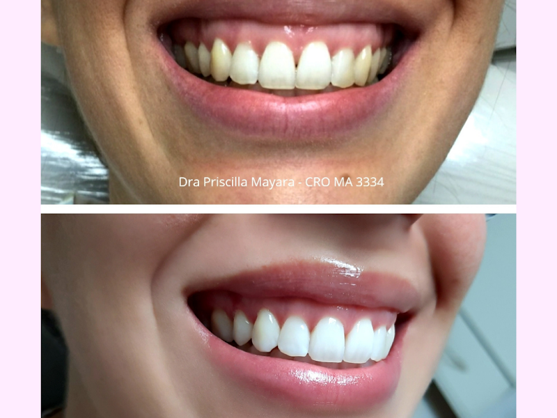 Foto 2 de Aura Odontologia Estética
