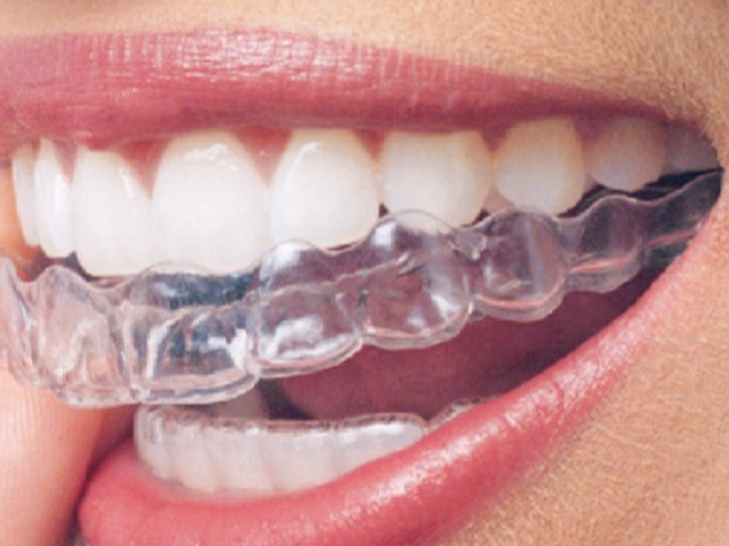 Foto 5 de Aurê Clinic Odontologia | Dentista Taquara