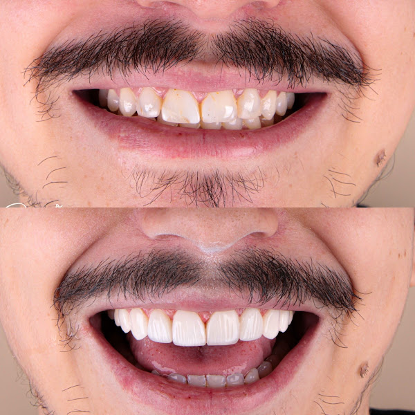 Foto 2 de Áurea odontologia estética