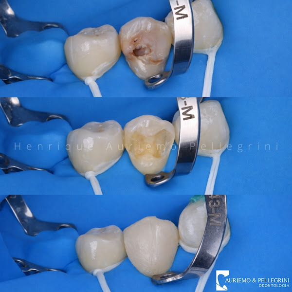 Foto 3 de Auriemo & Pellegrini Odontologia