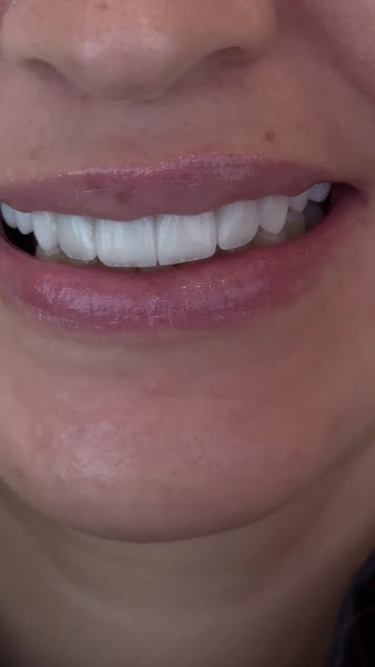 Foto 3 de Aurora Odontologia Estética