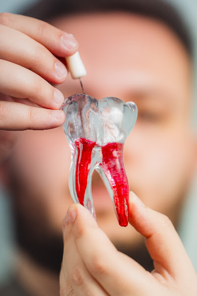 Foto 2 de Autoritá Odontologia | Tratamento de Canal e Implantes Dentários em Salto SP