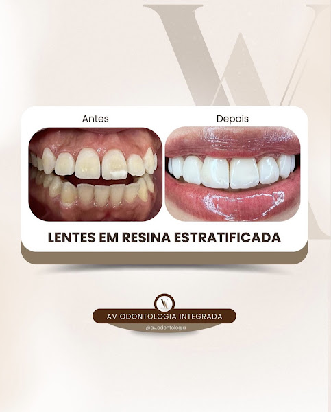 Foto 3 de AV ODONTOLOGIA INTEGRADA - Saúde, Sorriso & Autoestima.