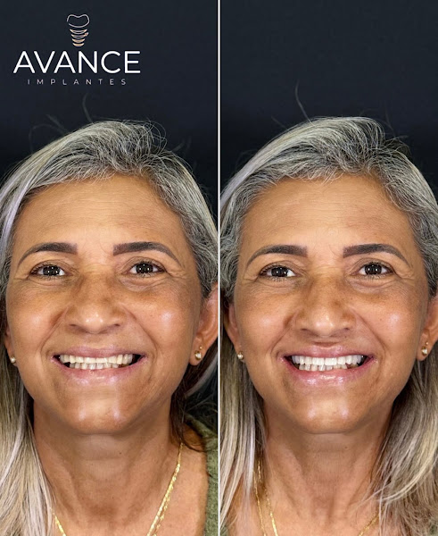 Foto 2 de Avance Implantes Ibirité
